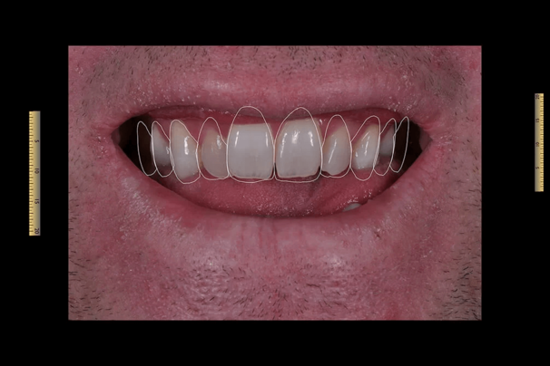 smiledesign_vorher_2.png